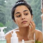 Why does acne get worse during the monsoon?