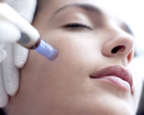 dermapen 4 treatment