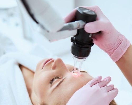 fractional co2 laser treatment